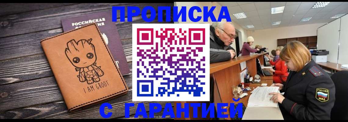 временная регистрация собственник в Калужской области